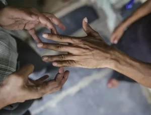 44 yıl sonra bir ilk! 2 ülkede cüzzam vakaları görülmeye başladı