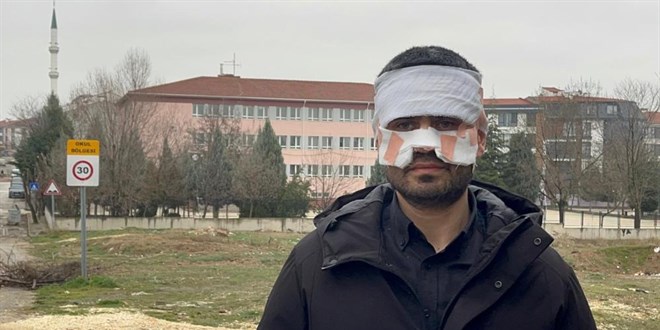 Eskişehir’de Okulda Çay Saldırısı: Öğretmenin Yüzü Yandı