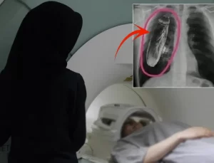 Hastaya “Göğsünde canlı böcek var” dendi, gerçek çok başka çıktı
