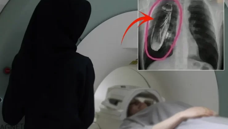 Hastaya “Göğsünde canlı böcek var” dendi, gerçek çok başka çıktı
