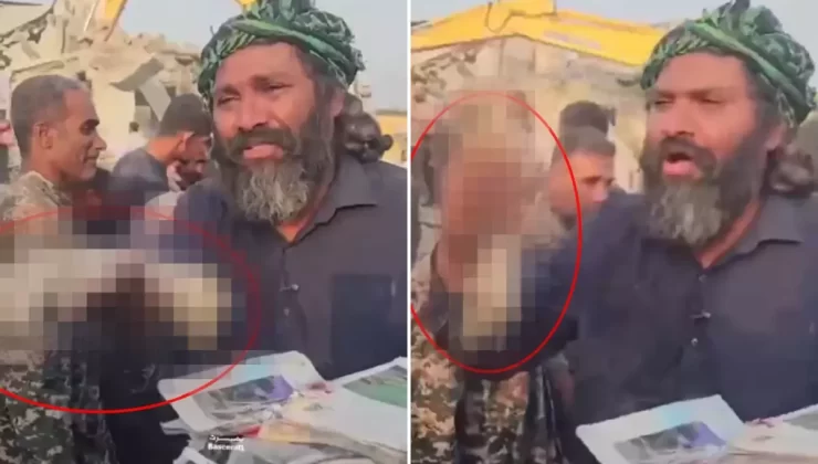 İran’da İlkokulda öldürülen kız çocuğunun kopan elini gösterip isyan etti: Dünya bu cinayeti görmeli